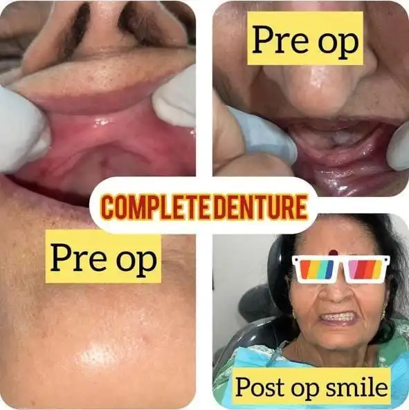 Geriatric prosthetic rehabilitation in banglore