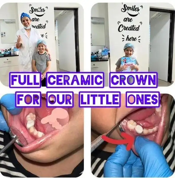 Pedodontics (Children Dentistry) in Bangalore